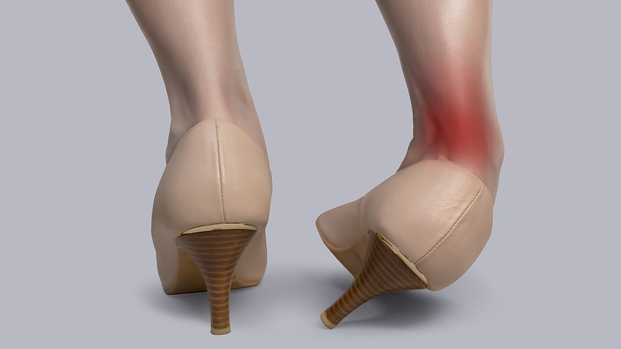 Illustration of a painful ankle sprain occurring while wearing high heels